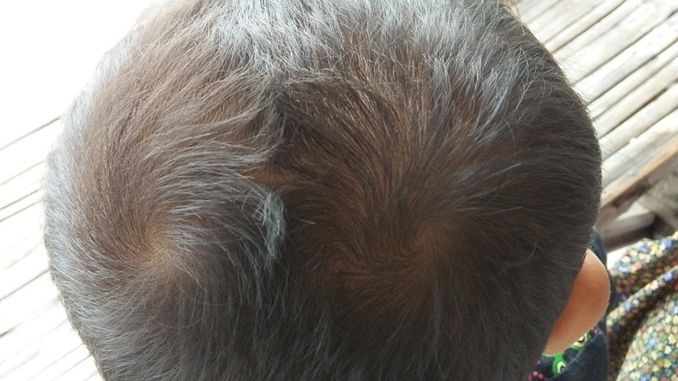 Anak dengan unyeng unyeng dua berarti nakal, mitos atau fakta?